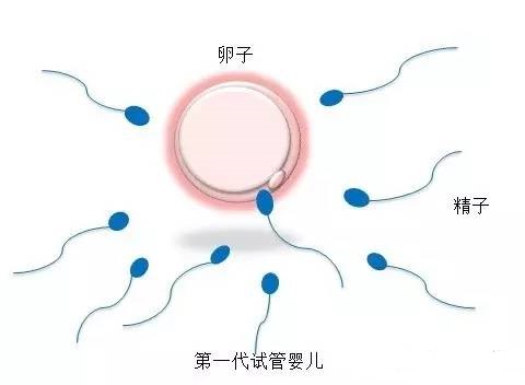 显微操作